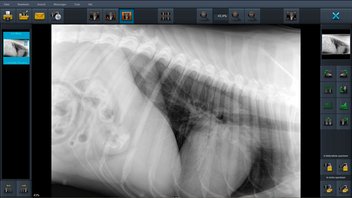 aqs diagnostic screen